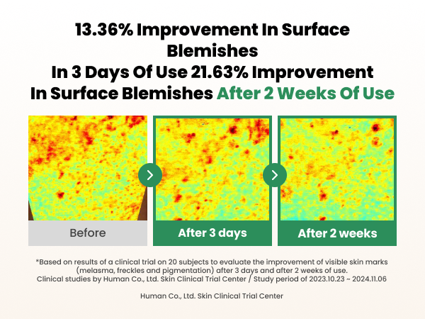 AXIS-Y Dark Spot Correcting Glow Serum Mini 5mI