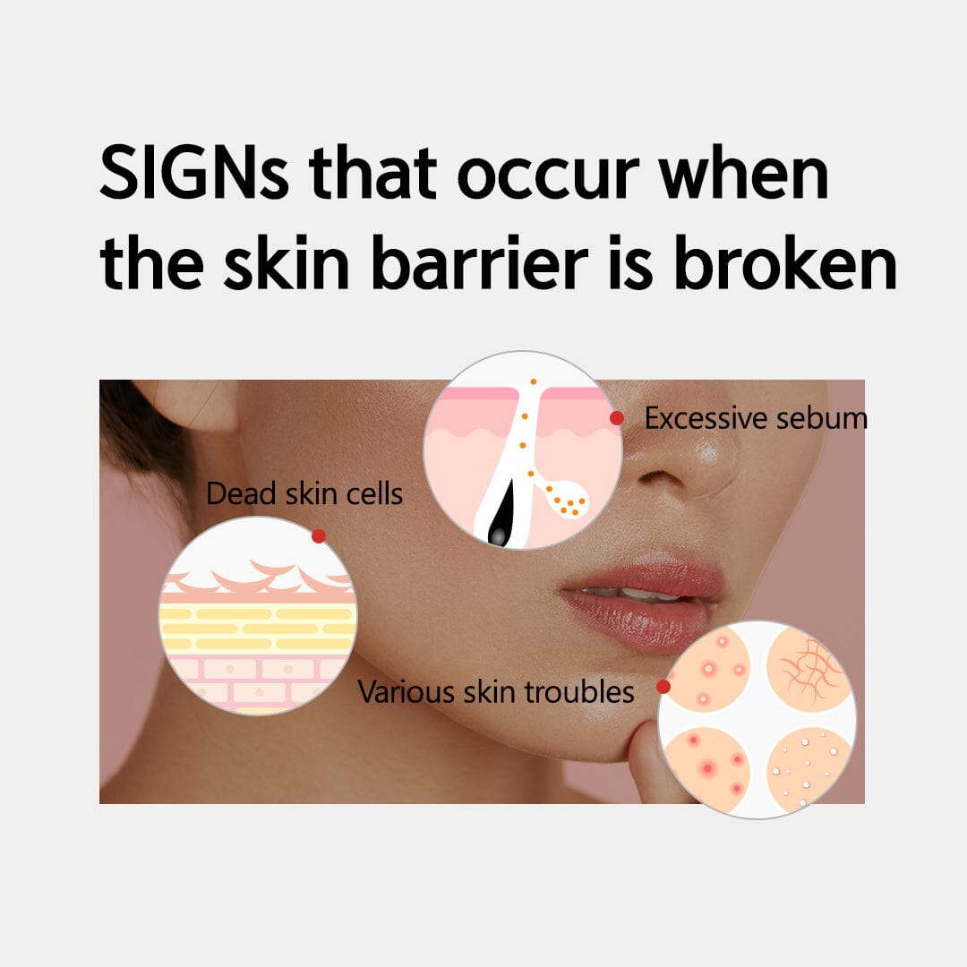 NACIFIC Origin Red Salicylic Acid Spot Cream 20ml - ORION XO Exclusive