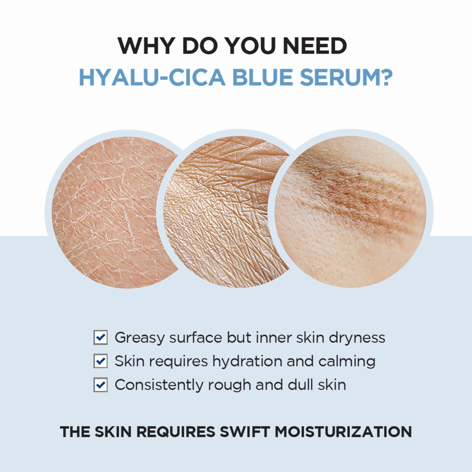 SKIN1004 Madagascar Centella Hyalu-Cica Blue Serum 50ml - ORION XO Exclusive
