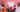 ORION XO Podcast Episode 4: Hair Fall and Scalp Care
