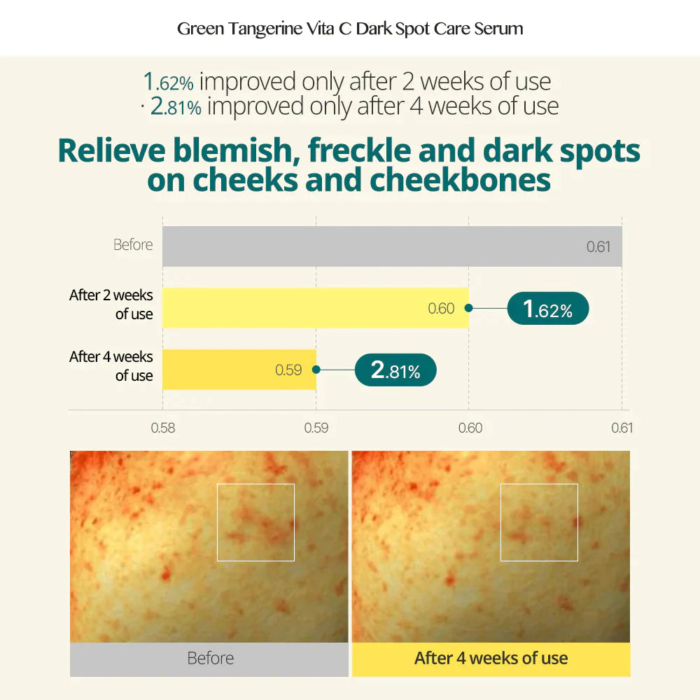 [Bank Transfer Offer] 🌈 Goodal Green Tangerine Vita C Dark Spot Care Serum 40ml Skin Care Goodal ORION XO Sri Lanka