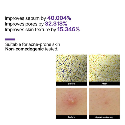 SOME BY MI Retinol Intense Reactivating Serum 30ml Skin Care SOME BY MI ORION XO Sri Lanka